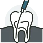 Root Canals